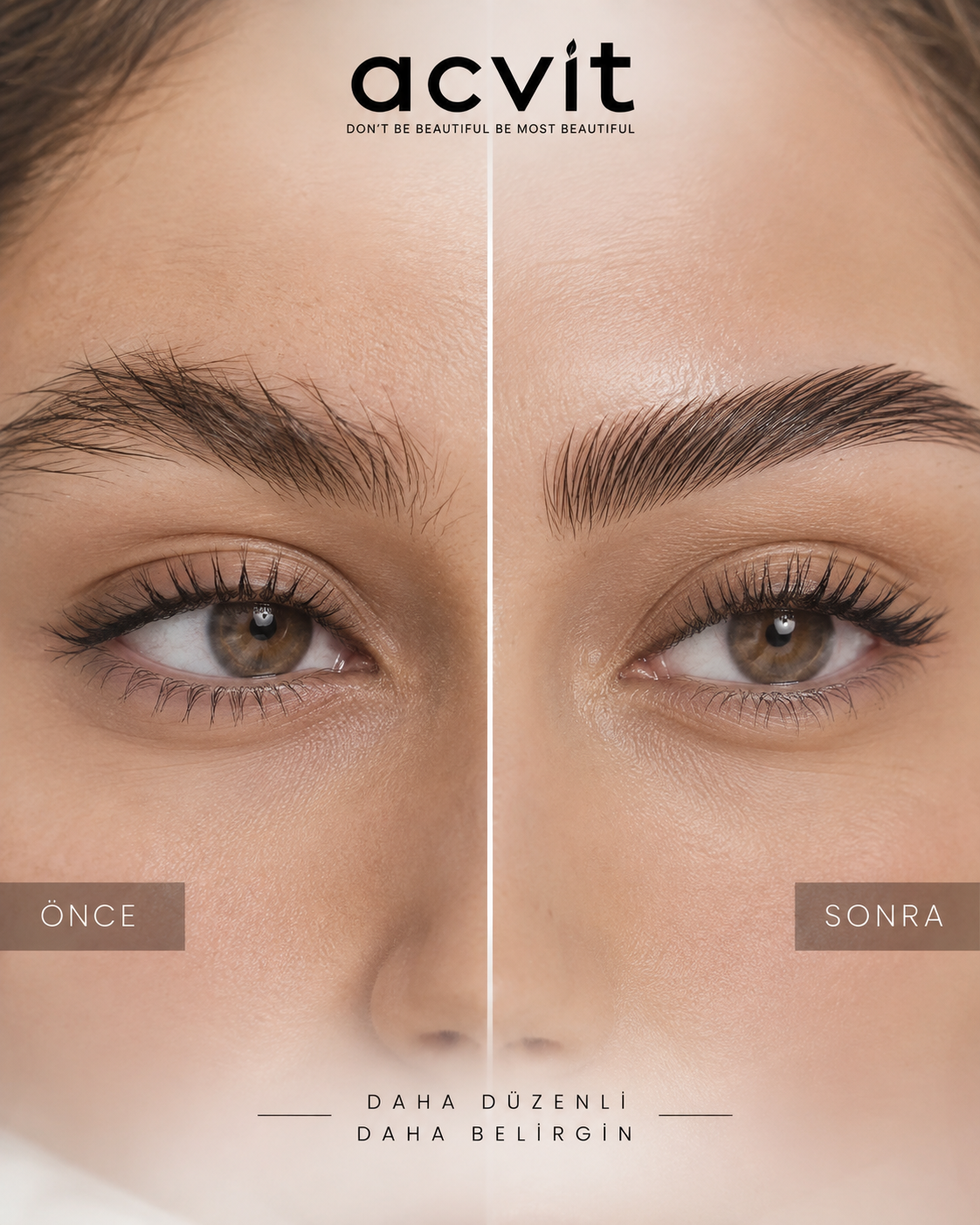 Kaş Sabitleyici, Dolgunlaştırıcı ve Şekillendirici Jel – 50 ML. - Görsel 6