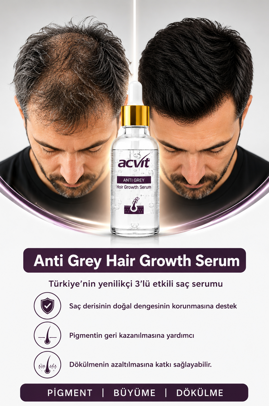 Anti Grey Hair Growth Serum – 50 ml - Görsel 2